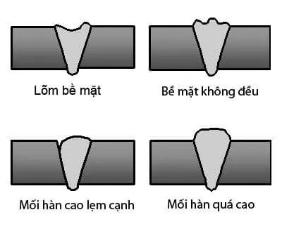 khuyet-tat-ve-hinh-dang-lien-ket-han